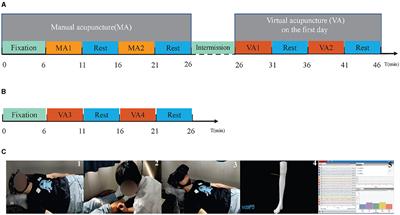 A novel acupuncture technique at the Zusanli point based on virtual reality and EEG: a pilot study